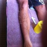skinny legs